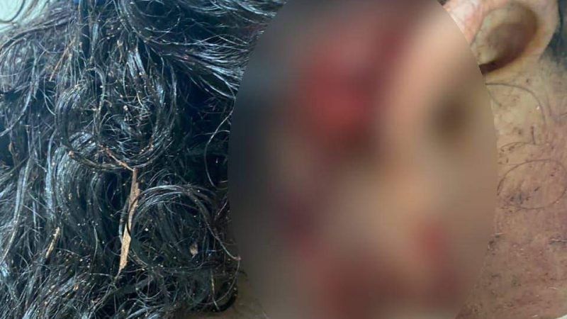 Dono de cachorro que atacou grávida em Guarapari é indiciado pela polícia