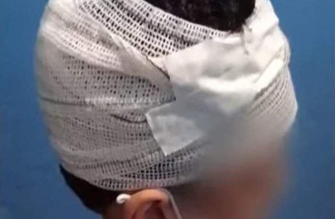 Menino de 7 anos passa por cirurgia após acidente em parquinho no ES