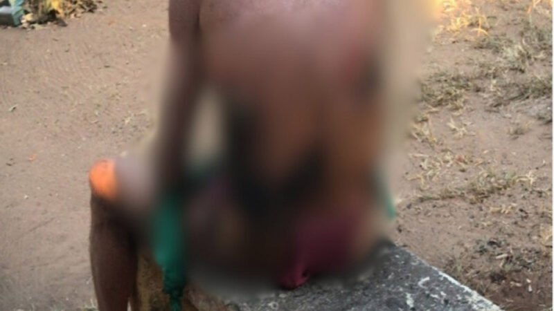 CRUELDADE | Adolescente de 12 anos é apreendido por atear fogo em homem que dormia em praça; vídeo