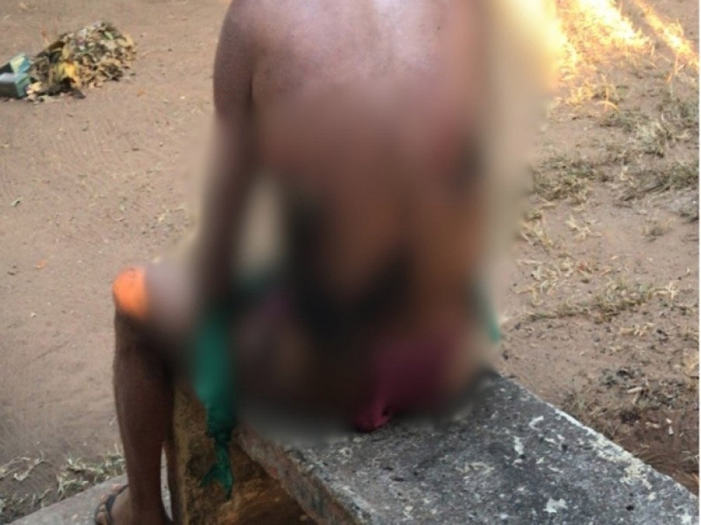 CRUELDADE | Adolescente de 12 anos é apreendido por atear fogo em homem que dormia em praça; vídeo